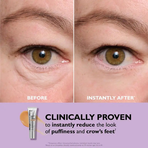 Instant Eye Lift Solution